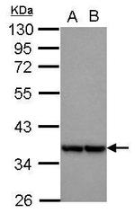 MRPL3 Polyclonal Antibody