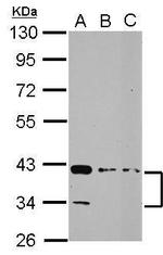 PDLIM3 Polyclonal Antibody