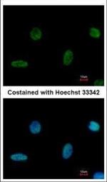 PGBD1 Polyclonal Antibody