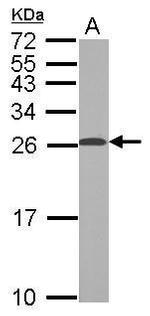 TPPP Antibody in Western Blot (WB)
