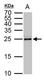 TPPP Antibody in Western Blot (WB)