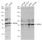 ZNF256 Polyclonal Antibody