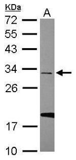 SNRNP35 Antibody in Western Blot (WB)