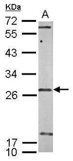 SNRNP35 Antibody in Western Blot (WB)