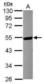 KATNA1 Polyclonal Antibody
