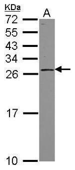GINS3 Polyclonal Antibody