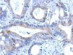 RNF166 Polyclonal Antibody