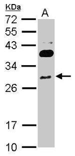RNF166 Antibody in Western Blot (WB)