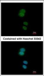 ZNF584 Polyclonal Antibody