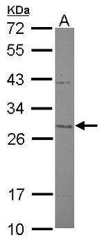 MTIF3 Polyclonal Antibody