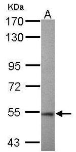 RNF92 Antibody in Western Blot (WB)