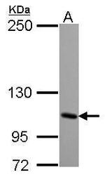 GRIK4 Polyclonal Antibody