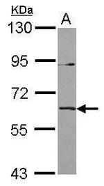 IL1RL2 Polyclonal Antibody