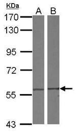 TCP-1 delta Antibody in Western Blot (WB)