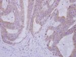 USP49 Antibody in Immunohistochemistry (Paraffin) (IHC (P))