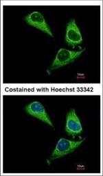 ARHGAP15 Polyclonal Antibody
