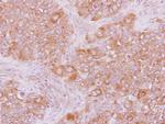 ARHGAP15 Antibody in Immunohistochemistry (Paraffin) (IHC (P))