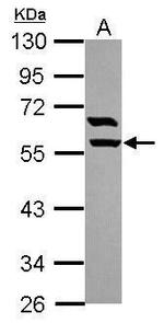 ARHGAP15 Antibody in Western Blot (WB)