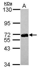ZNF587 Antibody in Western Blot (WB)