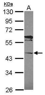 LACC1 Polyclonal Antibody