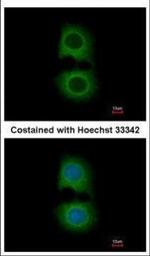 TMOD2 Polyclonal Antibody