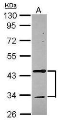 TMOD2 Antibody in Western Blot (WB)