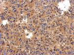 C1 inhibitor Polyclonal Antibody