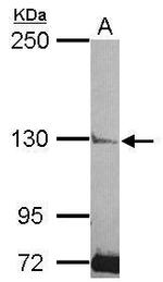 PLCL2 Antibody in Western Blot (WB)