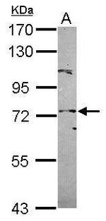 POT1 Polyclonal Antibody