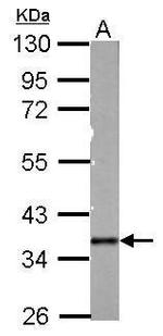 PDLIM3 Polyclonal Antibody