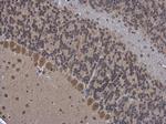 OGFOD1 Polyclonal Antibody