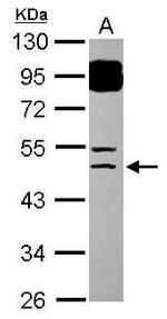 BTBD6 Antibody in Western Blot (WB)