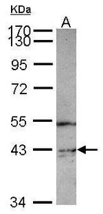 PIP4K2C Polyclonal Antibody