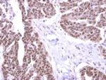 STK31 Antibody in Immunohistochemistry (Paraffin) (IHC (P))