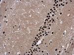 WDR62 Antibody in Immunohistochemistry (Paraffin) (IHC (P))