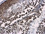 WDR62 Antibody in Immunohistochemistry (Paraffin) (IHC (P))