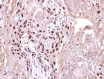 WDR62 Antibody in Immunohistochemistry (Paraffin) (IHC (P))