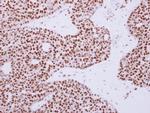RAD50 Polyclonal Antibody