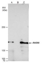 RAD50 Antibody in Immunoprecipitation (IP)