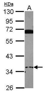 EID3 Polyclonal Antibody
