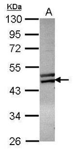 ZNF439 Polyclonal Antibody