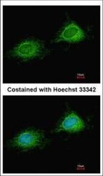 PITRM1 Polyclonal Antibody