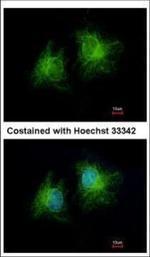 CCDC28B Polyclonal Antibody