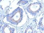 CCDC28B Antibody in Immunohistochemistry (Paraffin) (IHC (P))