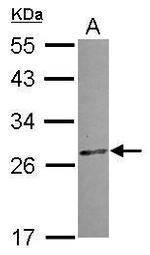 CCDC28B Antibody in Western Blot (WB)