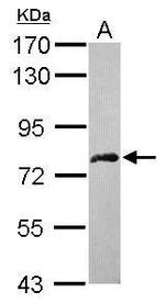 DDX59 Antibody in Western Blot (WB)