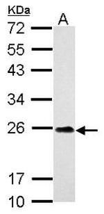 C9orf72 Antibody in Western Blot (WB)
