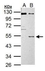 C9orf72 Antibody in Western Blot (WB)
