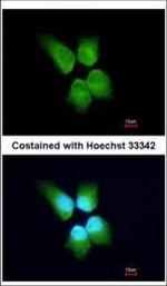 GINS4 Polyclonal Antibody