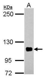 EPLIN Antibody in Western Blot (WB)